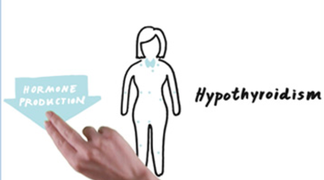 Synthroid patient Elisa talks about how to take her hypothyroidism medication the right way